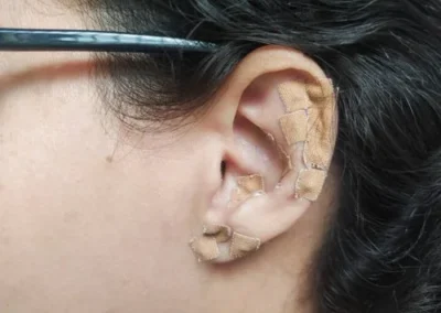 illustration auriculotherapie